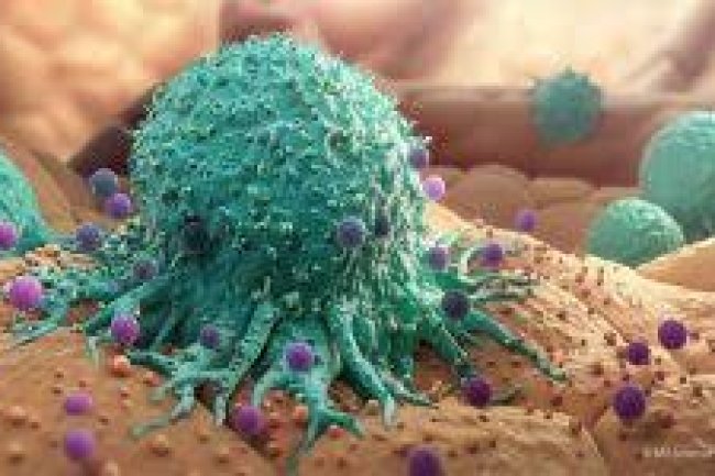 Top 10 causes of cancer?